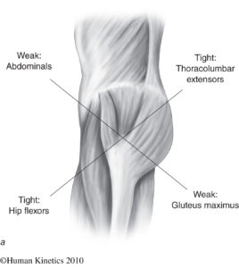 tight gluteus medius