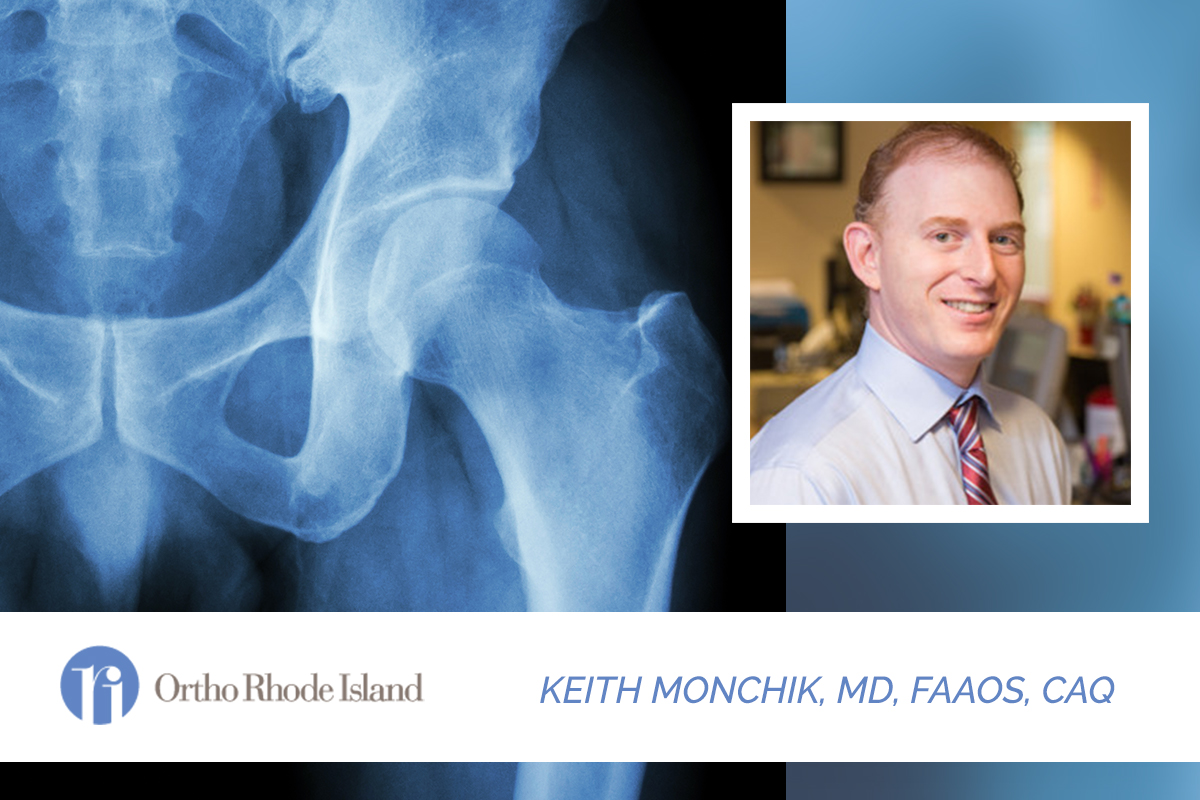 Trochanteric Hip Bursitis  Spine & Orthopedic Center